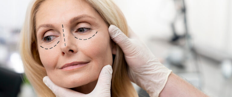 The Ultimate Guide to Facelifts